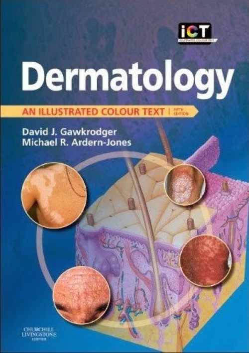 concise textbook of dermatology